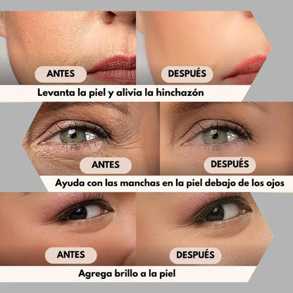 Esferas Faciales - Mejora la Firmeza y Frescura del Rostro